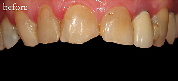 Before after 4 Before after 4