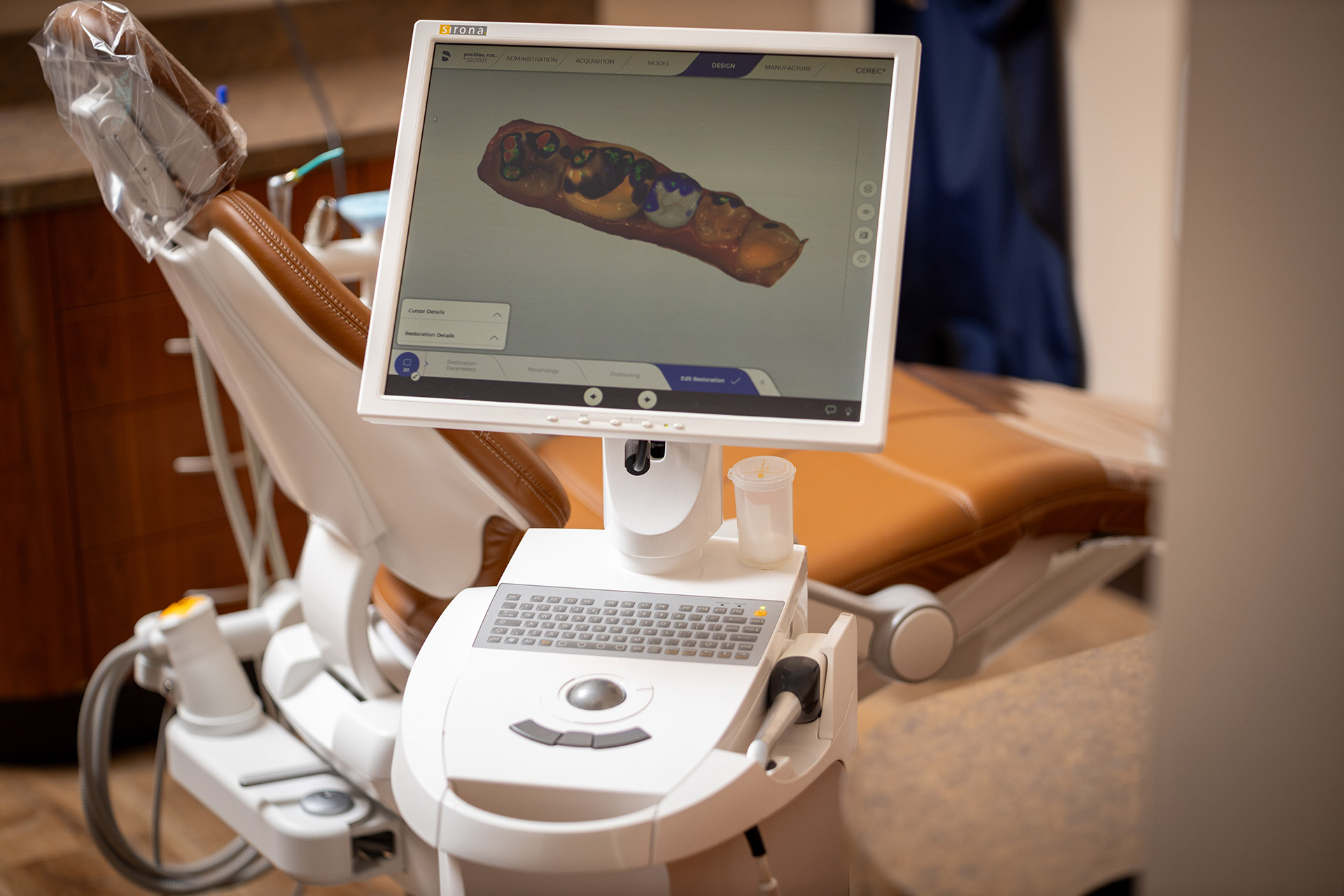 CEREC software designing a same-day dental crown CEREC software designing a same-day dental crown